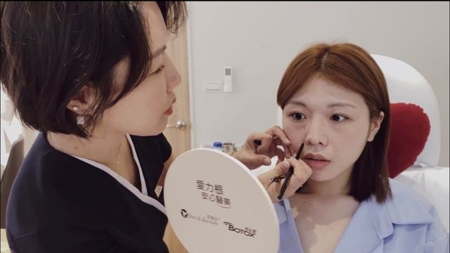 玻尿酸填補蘋果肌淚溝 肉毒咀嚼肌