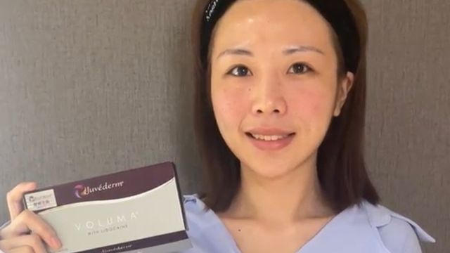 玻尿酸填補蘋果肌淚溝 肉毒咀嚼肌