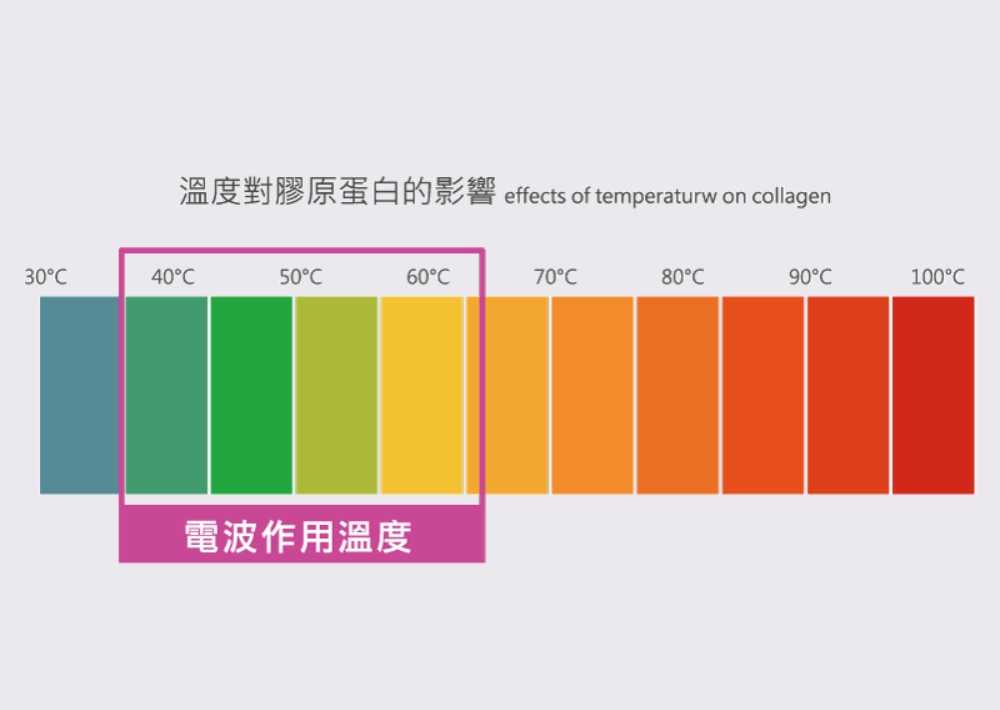 Oligio  玩美電波