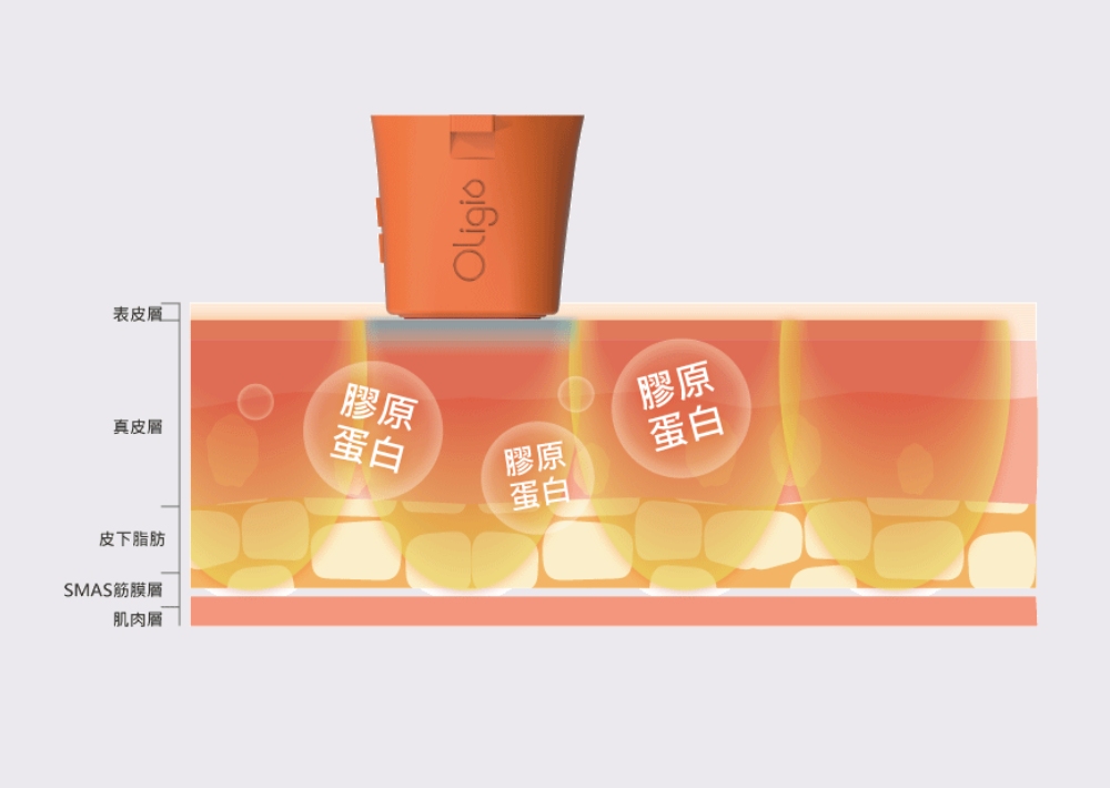 Oligio  玩美電波
