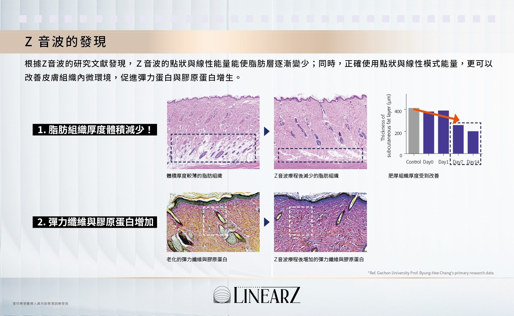 Linear Z( Z音波)