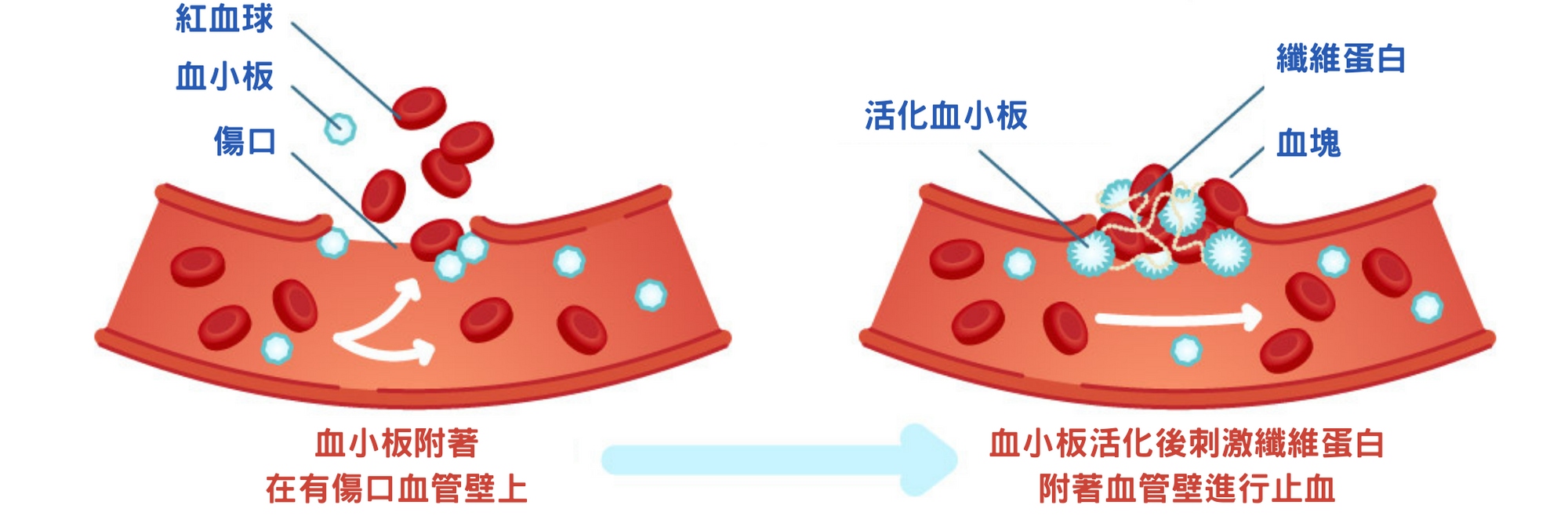 PLT生長因子凍晶