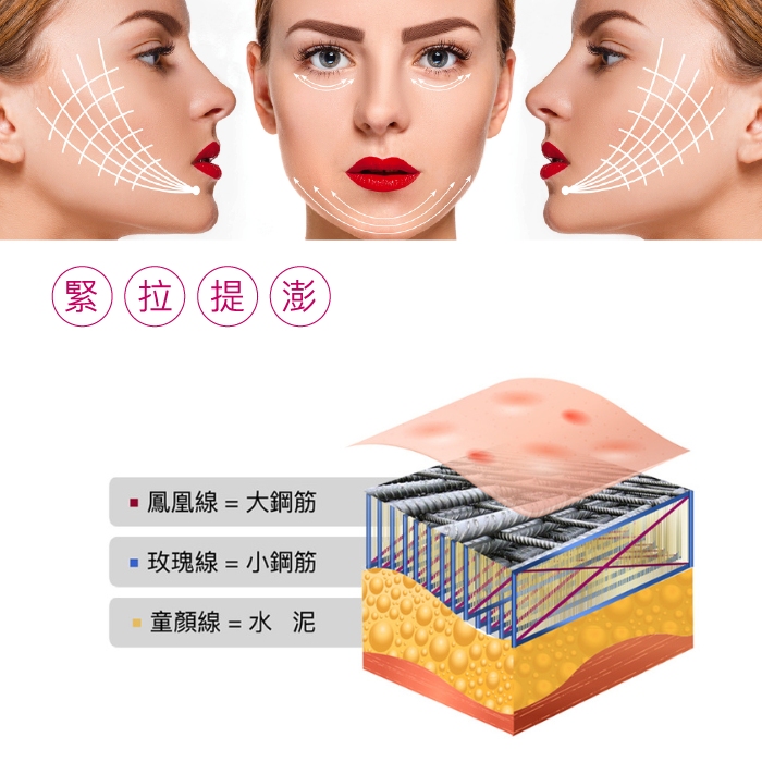 提美拉 MiracleThread 線雕 拉線 埋線