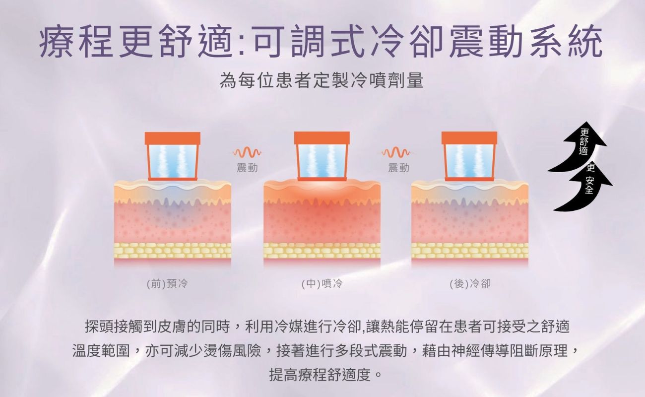 Oligio  玩美電波