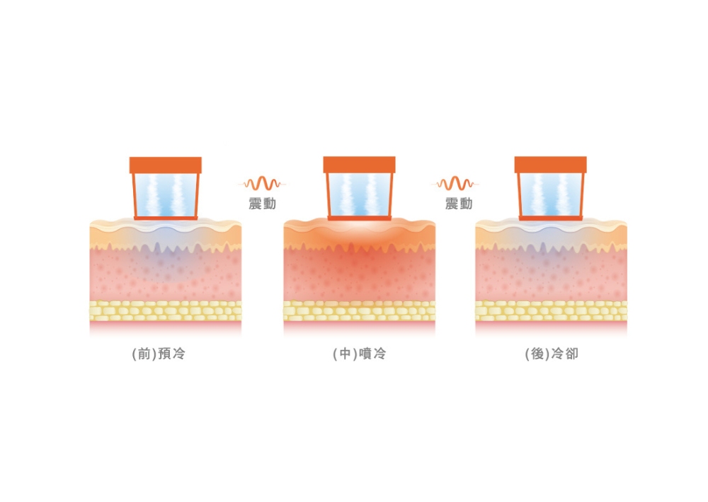 Oligio  玩美電波