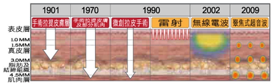 Ultra Skin超極限音波拉提