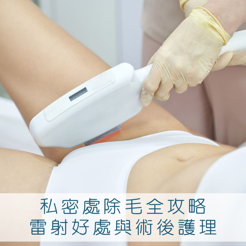 私密處除毛的神秘世界，台中除毛雷射選逸心美學