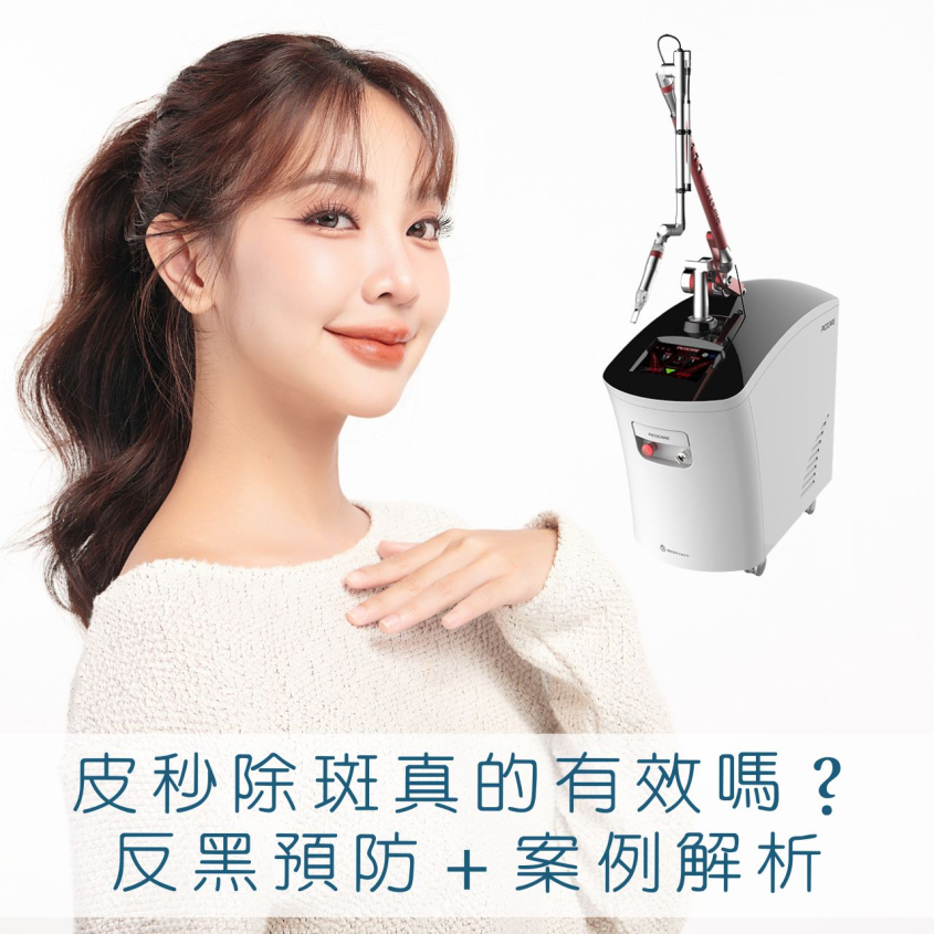 皮秒除斑多有效？破解皮秒反黑疑慮，台中除斑案例分享！
