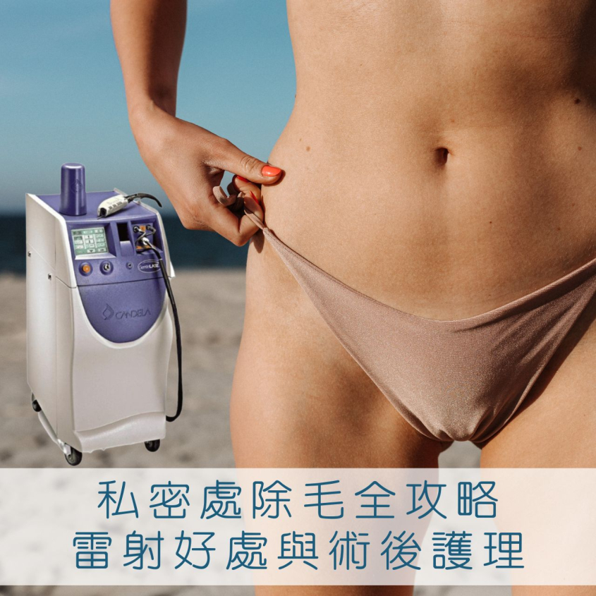 私密處除毛的神秘世界，台中除毛雷射選逸心美學
